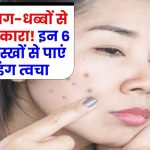 पुराने दाग-धब्बों से पायें छुटकारा! इन 6 असरदार घरेलू नुस्खों से पाएं ग्लोइंग त्वचा