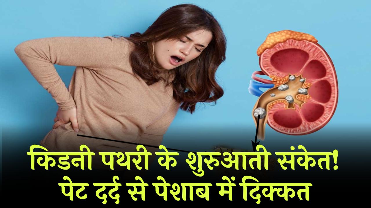 पेट दर्द से पेशाब में दिक्कत तक, किडनी में पथरी के शुरुआती संकेतों को ऐसे जानें