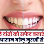 Teeth Whitening Tips: पीले दांतों को सफेद बनाएं इन आसान घरेलू नुस्खों से!