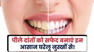 Teeth Whitening Tips: पीले दांतों को सफेद बनाएं इन आसान घरेलू नुस्खों से!