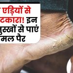 Crack heel home remedy: फटी एड़ियों से छुटकारा! इन आज़माए हुए घरेलू नुस्खों से पाएं कोमल पैर