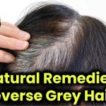 5 Natural Remedies to Reverse Grey Hairs