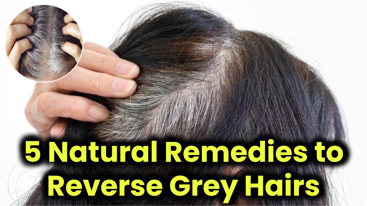 5 Natural Remedies to Reverse Grey Hairs