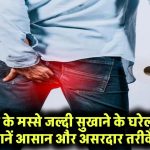 बवासीर के मस्से जल्दी सुखाने के घरेलू उपाय – जानें आसान और असरदार तरीके!