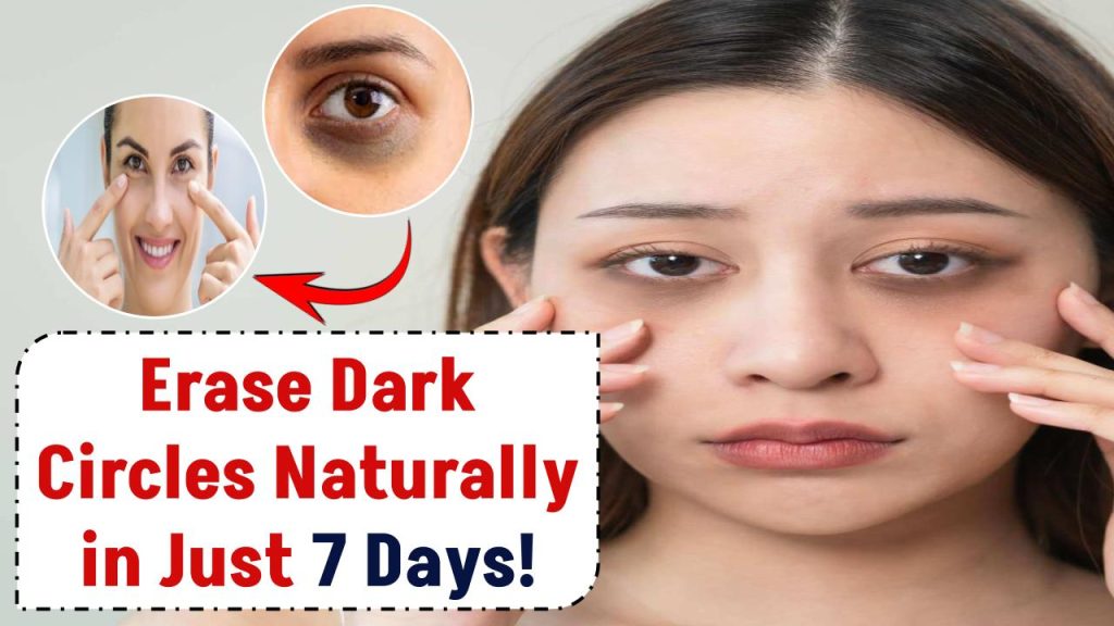 How to remove dark circles under eyes naturally