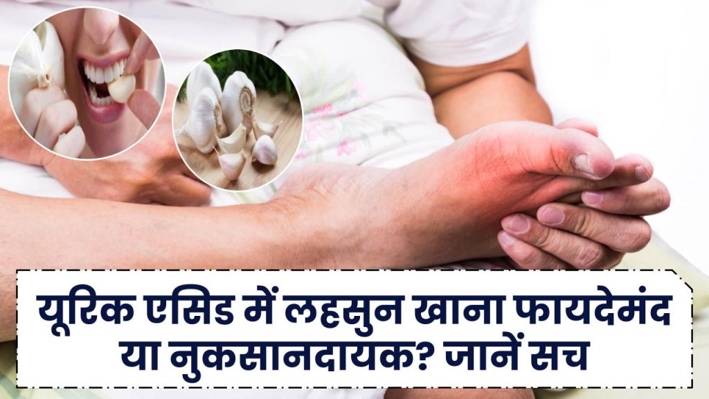 Uric Acid: यूरिक एसिड में लहसुन खाना फायदेमंद या नुकसानदायक? जानें सच