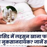 Uric Acid: यूरिक एसिड में लहसुन खाना फायदेमंद या नुकसानदायक? जानें सच