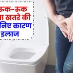 बार-बार पेशाब रुक-रुक कर आना खतरे की घंटी! जानिए इसके कारण और इलाज