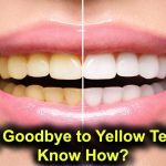 Say Goodbye to Yellow Teeth