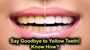 Say Goodbye to Yellow Teeth