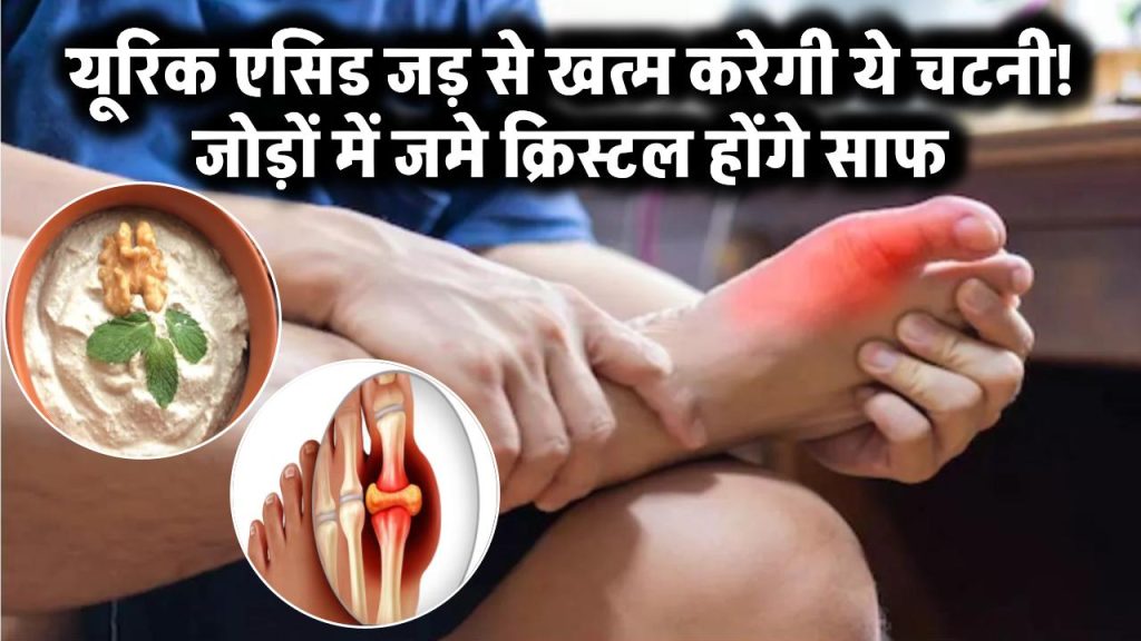 Uric Acid Kaise Kam Kare: यूरिक एसिड को जड़ से खत्म करेगी ये स्पेशल चटनी! जोड़ों में जमे क्रिस्टल होंगे साफ 