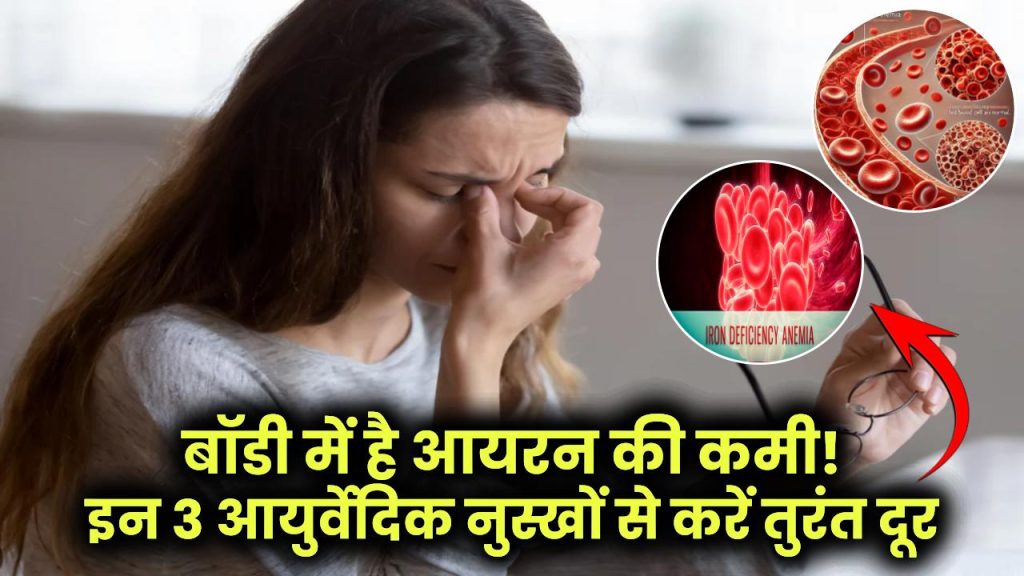 Iron Deficiency: 30% आबादी है आयरन की कमी की शिकार! इन 3 आयुर्वेदिक नुस्खों से करें तुरंत दूर