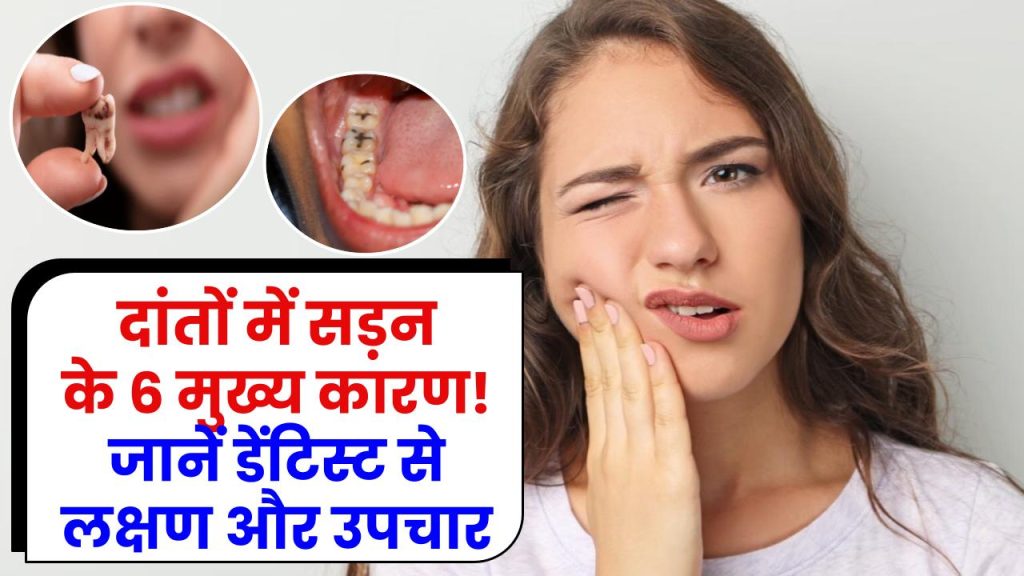 Toothache Day: दांतों में सड़न के 6 मुख्य कारण! जानें डेंटिस्ट से लक्षण और उपचार 