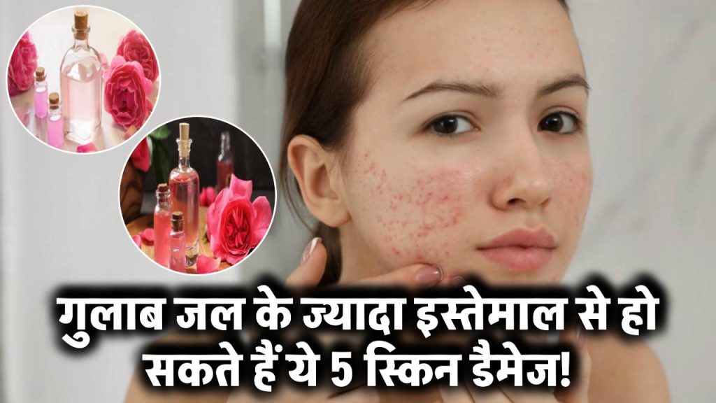 Rose Water Side Effects: ज्यादा गुलाब जल लगाने से हो सकता है नुकसान! जानें स्किन को होने वाले ये 5 बड़े डैमेज