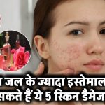 Rose Water Side Effects: ज्यादा गुलाब जल लगाने से हो सकता है नुकसान! जानें स्किन को होने वाले ये 5 बड़े डैमेज