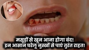 Gum Bleeding Remedies: मसूड़ों से खून आना होगा बंद! इन आसान घरेलू नुस्खों से पाएं तुरंत राहत!