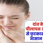 Toothache Remedies: दांत के दर्द, पीलापन और कीड़ों से छुटकारा पाने के आसान नुस्खे!