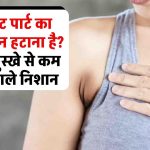 प्राइवेट पार्ट का कालापन हटाना है? घरेलू नुस्खे और मेडिकल ट्रीटमेंट से कम होंगे गहरे काले निशान