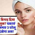 Winter Skincare: सर्दियों में रूखे और फटते हाथों से छुटकारा! आज़माएं ये जादुई घरेलू नुस्खा और पाएं मुलायम त्वचा