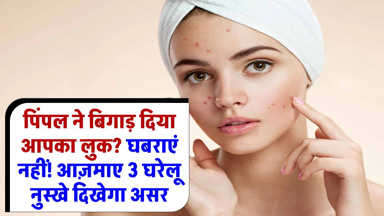 Winter Skincare: सर्दियों में रूखे और फटते हाथों से छुटकारा! आज़माएं ये जादुई घरेलू नुस्खा और पाएं मुलायम त्वचा