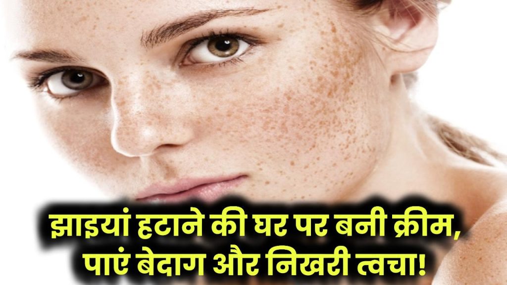 Homemade cream for pigmentation: झाइयां हटाने की घर पर बनी क्रीम – पाएं बेदाग और निखरी त्वचा!