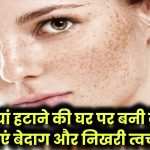 Homemade cream for pigmentation: झाइयां हटाने की घर पर बनी क्रीम – पाएं बेदाग और निखरी त्वचा!