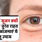 Eye Swelling: आंखों में सूजन क्यों आती है? जानिए कारण और तुरंत राहत के लिए आजमाएं ये घरेलू उपाय