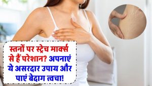 स्तनों पर स्ट्रेच मार्क्स से हैं परेशान? अपनाएं ये असरदार उपाय और पाएं बेदाग त्वचा! घरेलू नुस्खों और नेचुरल ट्रीटमेंट दिखेगा असर? अभी पढ़ें!