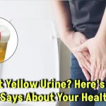 Why Is Your Urine Bright Yellow? Here’s What It Reveals About Your Healt