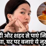 Acne Scars Removal: हल्दी और शहद से पाएं दाग-धब्बों से मुक्त साफ और निखरी त्वचा, घर पर बनाएं ये नुस्खा