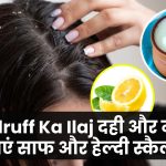 Dandruff Ka Ilaj: दही और नींबू से पाएं साफ और हेल्दी स्कैल्प