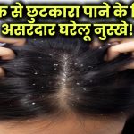 Dandruff Ka Ilaj: डैंड्रफ से हमेशा के लिए छुटकारा पाने के लिए अपनाएं ये असरदार घरेलू नुस्खे!