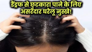 Dandruff Ka Ilaj: डैंड्रफ से हमेशा के लिए छुटकारा पाने के लिए अपनाएं ये असरदार घरेलू नुस्खे!