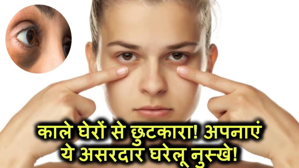 Dark Circles Removal: आंखों के काले घेरों से छुटकारा पाने के लिए आजमाएं ये असरदार घरेलू नुस्खे!