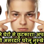 Dark Circles Removal: आंखों के काले घेरों से छुटकारा पाने के लिए आजमाएं ये असरदार घरेलू नुस्खे!