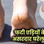 Foot Care Tips: फटी एड़ियों और खराब पैरों को ठीक करने के लिए अपनाएं ये आसान घरेलू नुस्खे!