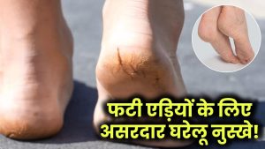Foot Care Tips: फटी एड़ियों और खराब पैरों को ठीक करने के लिए अपनाएं ये आसान घरेलू नुस्खे!
