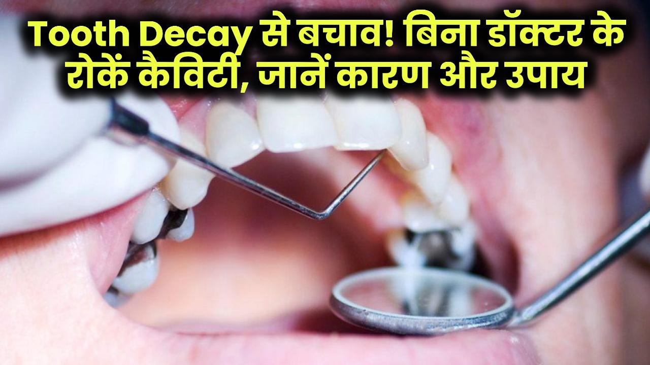 Tips To Prevent Tooth Decay: दांतों की सड़न से हैं परेशान? बिना डॉक्टर के ऐसे करें इलाज, जानें कैविटी के कारण और बचाव के उपाय!