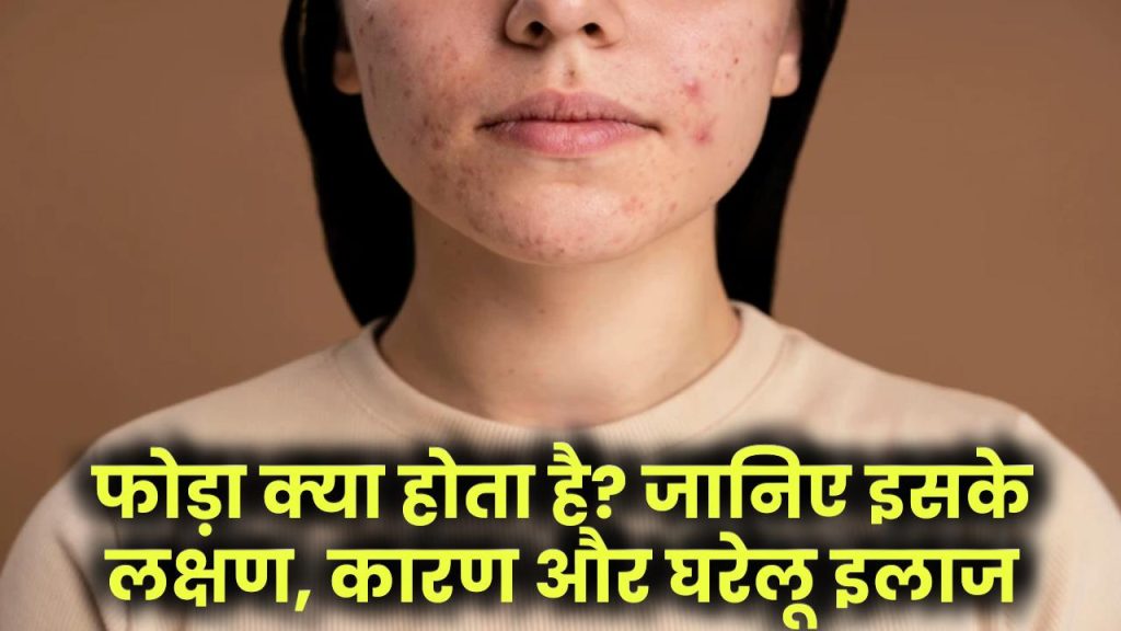 Abscess Meaning in Hindi: फोड़ा क्या होता है? जानिए इसके लक्षण, कारण और घरेलू इलाज