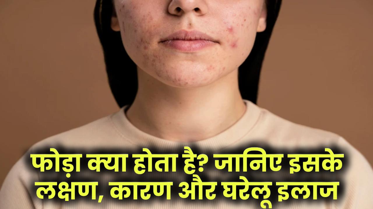 Abscess Meaning in Hindi: फोड़ा क्या होता है? जानिए इसके लक्षण, कारण और घरेलू इलाज