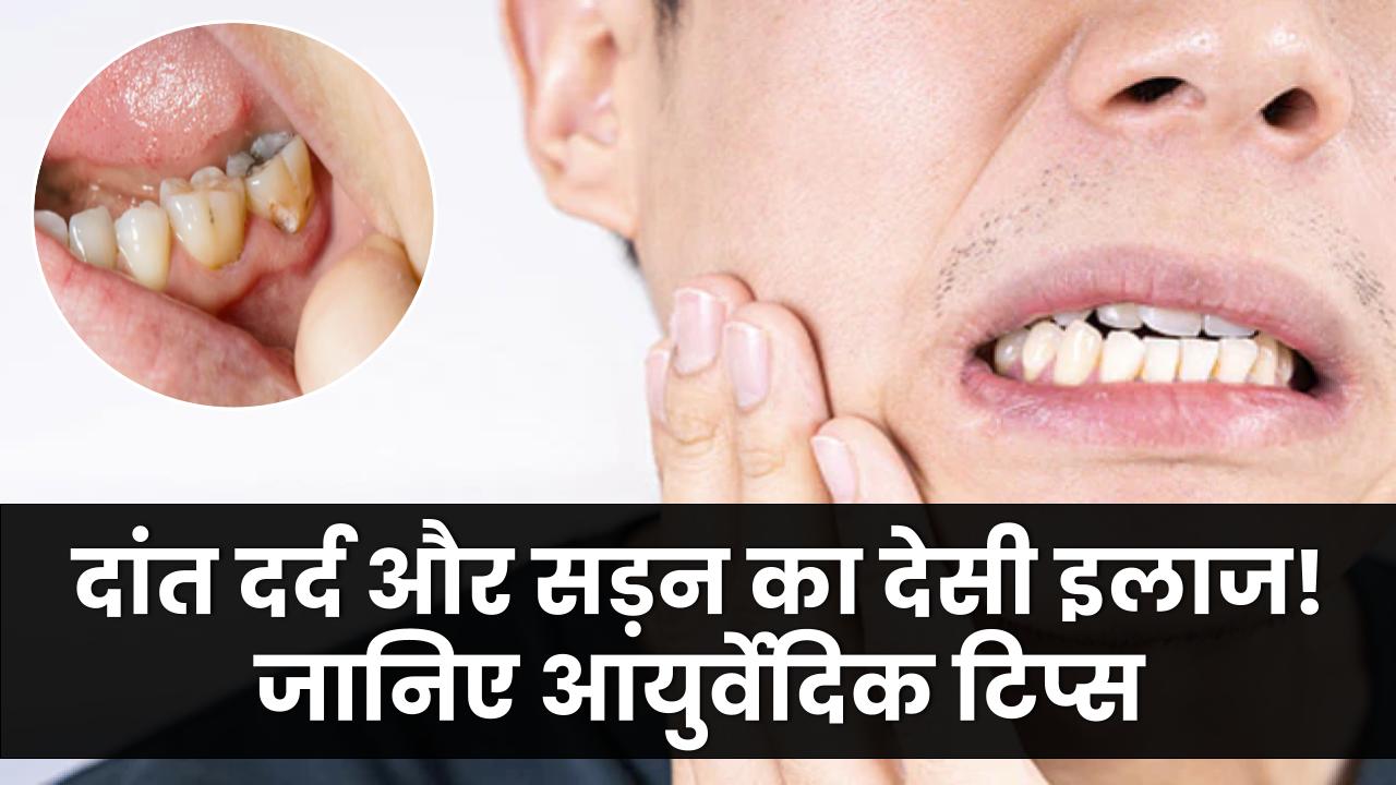 दांतों का दर्द और सड़न खत्म करने वाला देसी नुस्खा! आयुर्वेद डॉक्टर की चमत्कारी टिप्स जानिए