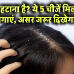 डैंड्रफ का सफाया चाहते हैं? इन 5 चीजों को मिलाकर लगाएं, दिखेगा कमाल का फर्क