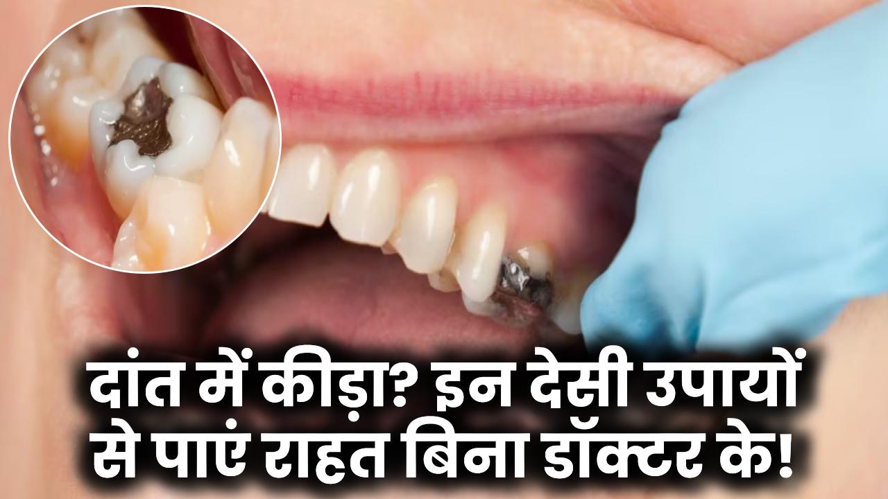 Health Tips: दांत में लगा है कीड़ा? इन 4 देसी चीज़ों से पाएं बिना डॉक्टर के छुटकारा!