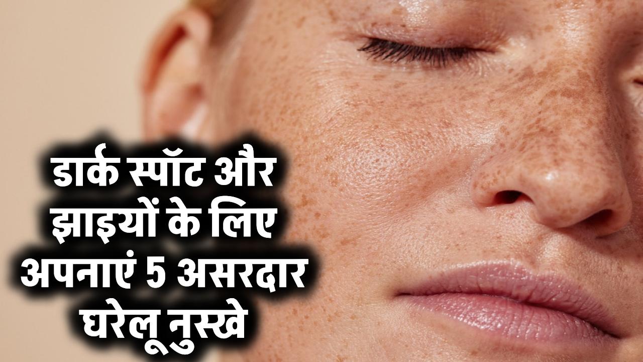 डार्क स्पॉट, सन बर्न और झाइयों को कहें अलविदा! बस अपनाएं ये 5 चमत्कारी घरेलू नुस्खे