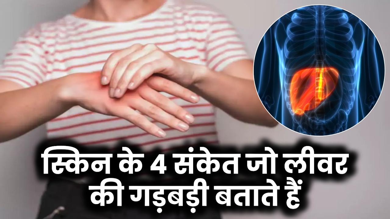 स्किन पर दिखें ये 4 खतरनाक संकेत? तुरंत समझें लीवर की गड़बड़ी और दौड़ें अस्पताल