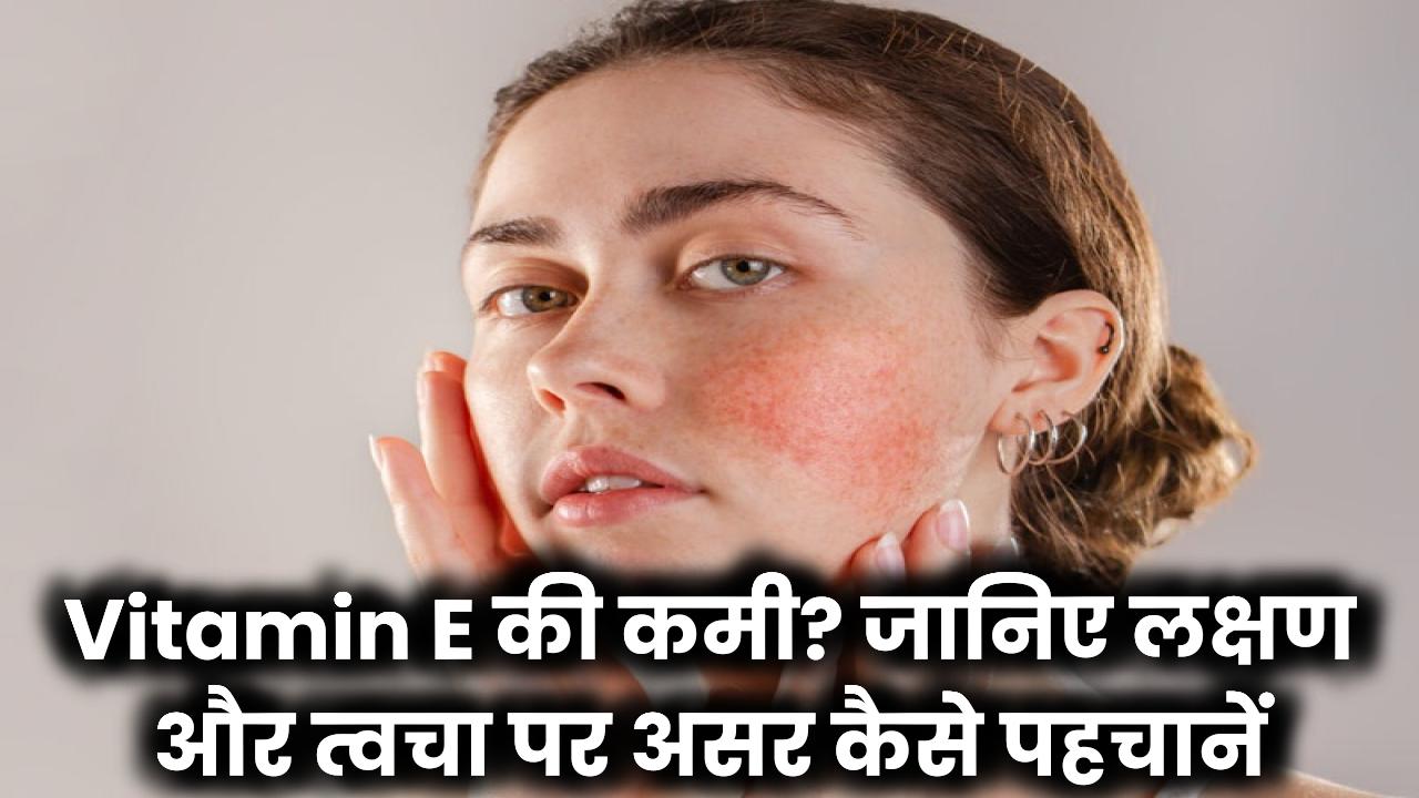 Vitamin E Deficiency: कैसे पहचानें लक्षण, जानें त्वचा और सेहत पर पड़ने वाले असर