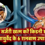 बिना सर्जरी घुल जाएंगे किडनी स्टोन! जानिए आयुर्वेद डॉक्टर के 6 रामबाण उपाय