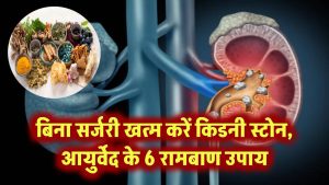 बिना सर्जरी घुल जाएंगे किडनी स्टोन! जानिए आयुर्वेद डॉक्टर के 6 रामबाण उपाय