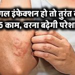 फंगल इंफेक्शन हो तो तुरंत करें ये 5 काम – वरना बढ़ेगी परेशानी