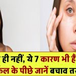 सिर्फ स्ट्रेस ही नहीं! आंखों के नीचे काले घेरे होने के ये 7 और कारण भी जानें, बचने के आसान उपाय भी शामिल
